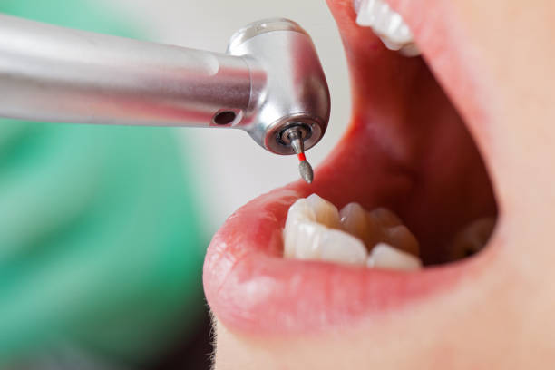 Best Emergency Broken Tooth Repair in Newberry, SC